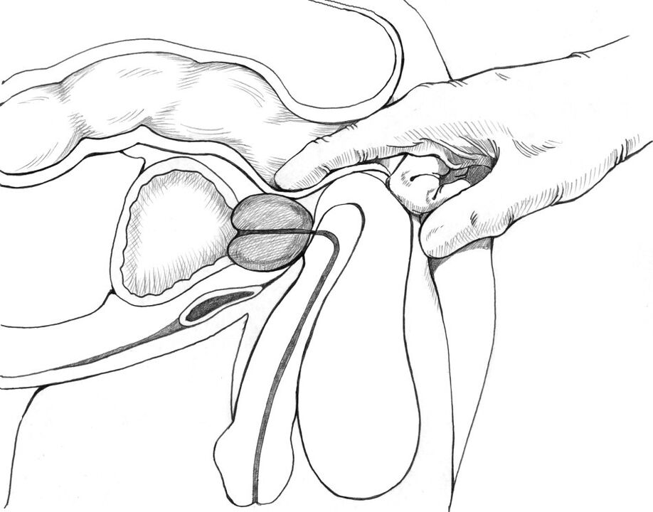 Prostatako masajea prostatitisaren tratamendu metodoen multzoan sartzen da
